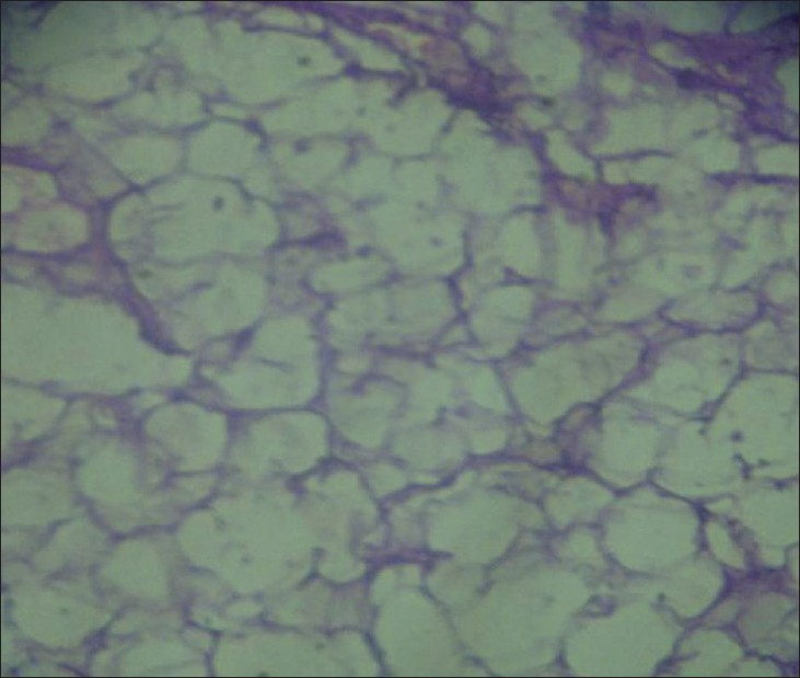 Histopathology shows abundant adipose tissue.