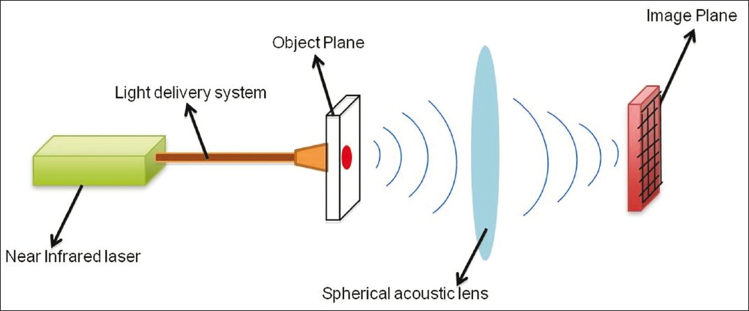 Acoustic lens-based photoacoustic imaging. Object plane lies within the tissue and an ultrasound detector placed in the image plane will collect focused PA signals.