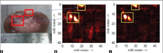 Photoacoustic images of the lamb kidney. (a) Photograph of the lamb kidney. (b) and (c) The PA images of the kidney obtained in the coronal plane from the anterior to posterior direction at an interval of 0.3 mm. The bright spots in the yellow-colored boxes of (b), and (c) the PA signal obtained from the area within the red boxes as shown in figure (a)