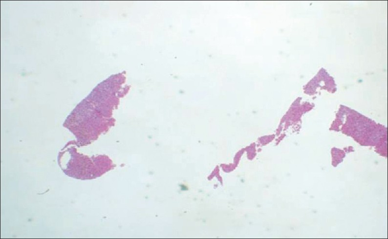 Example of a fragmented specimen.