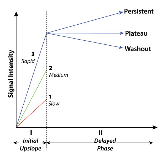 Time-signal intensity curve for breast lesions. A type I curve shows