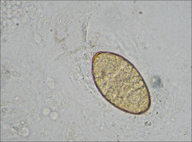 High power (400×) view of an F. hepatica egg in a stool sample.