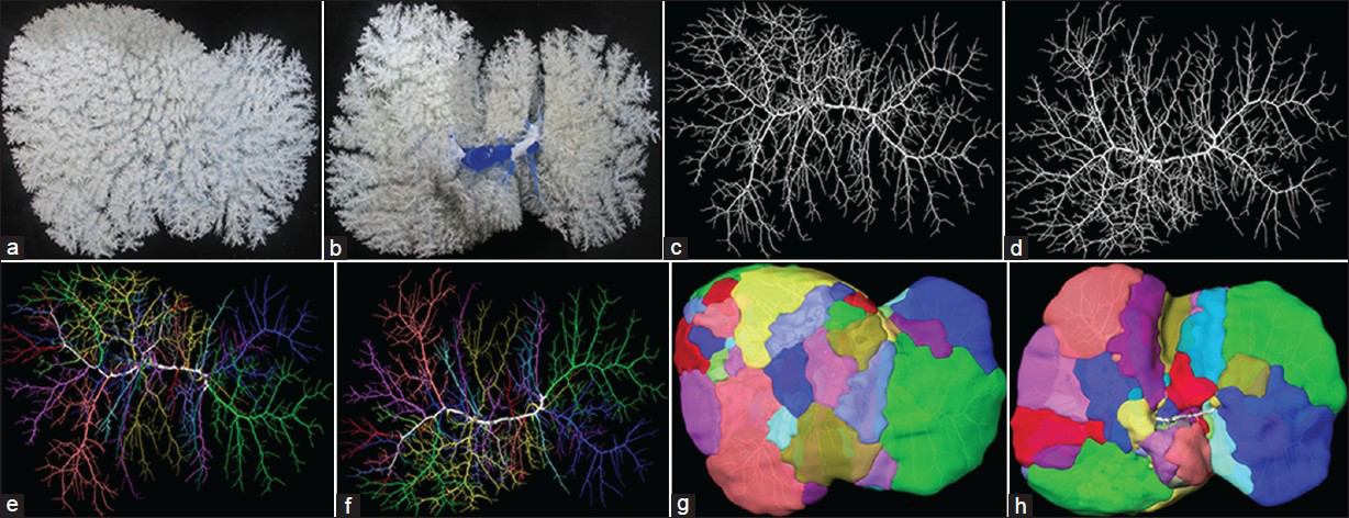 Portal venous territories in a human liver. All figures are from the same liver, thus excluding any anatomical variation in the branching pattern. (a) Front view and (b) the posterior (also called inferior) view of the native portal venous corrosion cast; (c) Front view and (d) the posterior view of the portal venous branching pattern as reconstructed from CT images. The liver investigated had 24 second-order branches; (e) Front view and (f) the posterior view reveal the portal venous branching pattern with all second-order branches of the liver and the major third-order branches to the right hemiliver marked by different colors; (g) Front view and (h) the posterior view of the corresponding second and third-order territories.