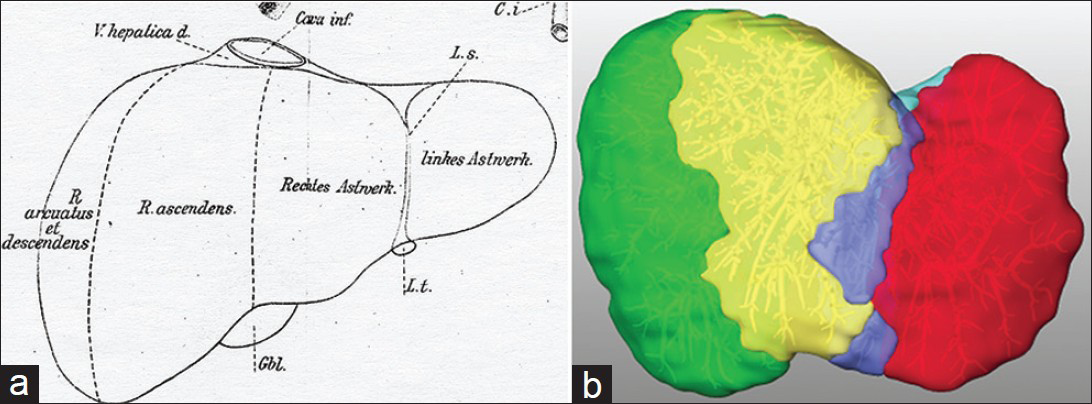 The concept of 4 sectors. (a) Original illustration by Rex.[15] (b) As applied to the corrosion cast.