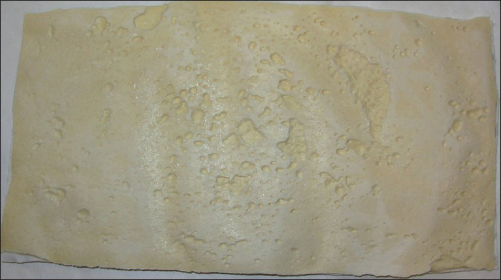 Photograph of a single sheet of prehydrated AlloDerm®. Once hydrated, the AlloDerm® can be folded, rolled, and layered. Dermal matrices other than AlloDerm® such as porcine derived matrices are similar in appearance.