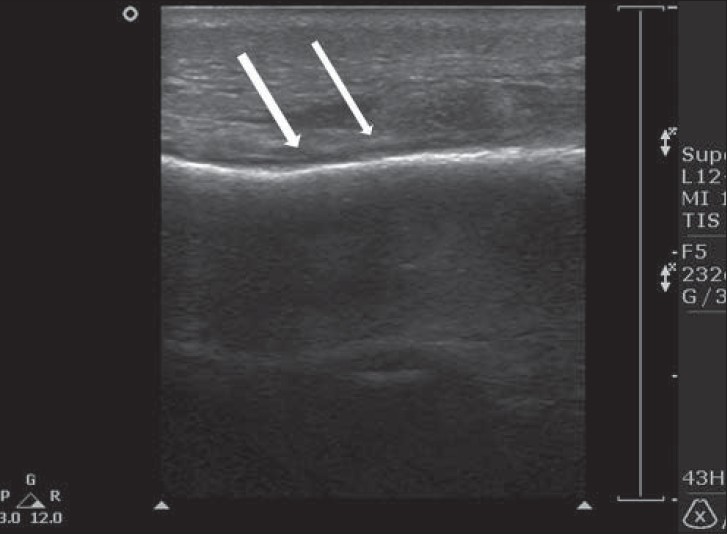 Ultrasound Findings of the Painful Ankle and Foot - Journal of Clinical