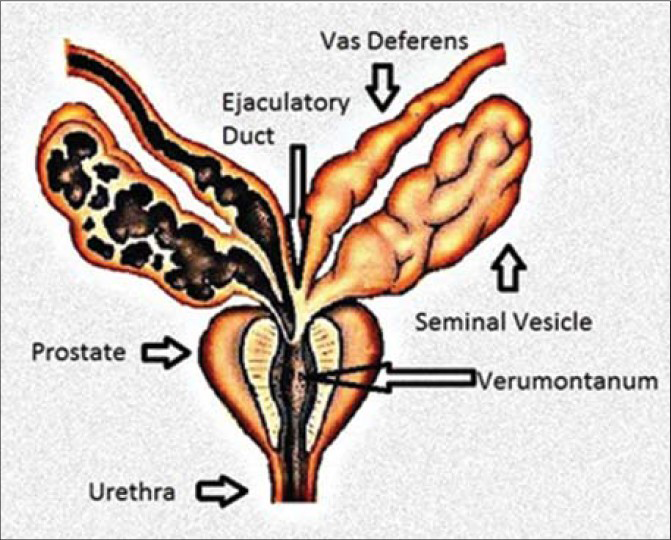 where are the seminal vesicles