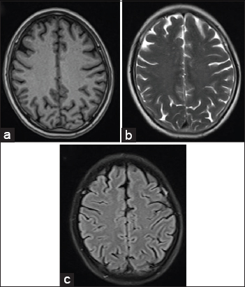 18-year-old adult female who presented to the emergency department in an unconscious state with fever and rash was diagnosed with scrub typhus. The routine MRI sequences (a) T1, (b) T2, and (c) FLAIR show no abnormal signal intensity in the brain parenchyma.