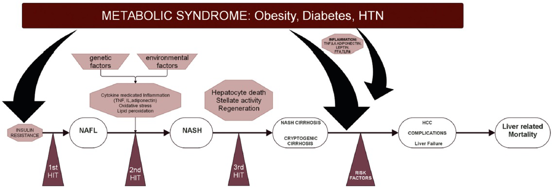 Summary of pathogenesis of NAFLD.