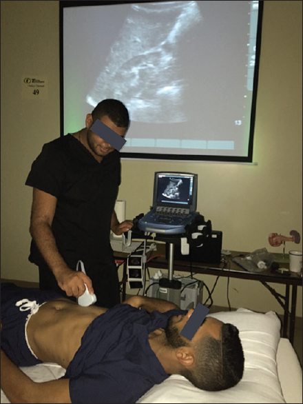 Ultrasound room conditions during small group teaching. Images obtained during hands-on are simultaneously displayed on the screen of the compact micromax unit and the larger screen in the laboratory room allowing for all the students in the laboratory to view at the same time, and encouraging for team work. This student is scanning the right flank of his fellow along sagittal and transverse planes. Both screens are displaying the right kidney with its normal corticomedullary echotexture differentiation.