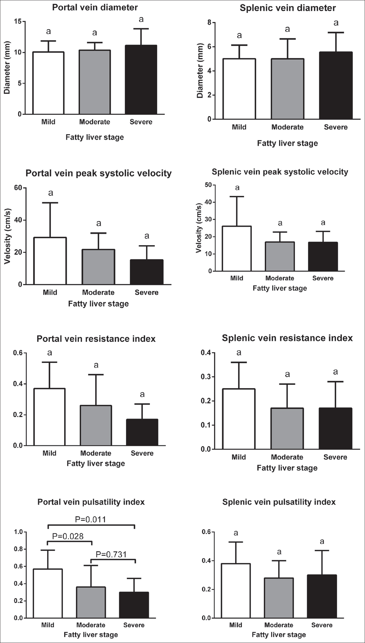 Comparison of mean ± standard deviation of color Doppler findings of portal and splenic veins in different stages of fatty liver based on sonography.