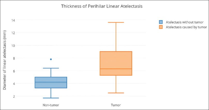 Thickness of perihilar linear atelectasis was compared between the atelectasis caused by bronchogenic carcinoma or benign conditions.