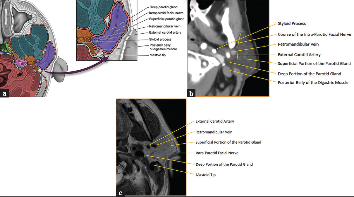 Review of the Major and Minor Salivary Glands, Part 1: Anatomy