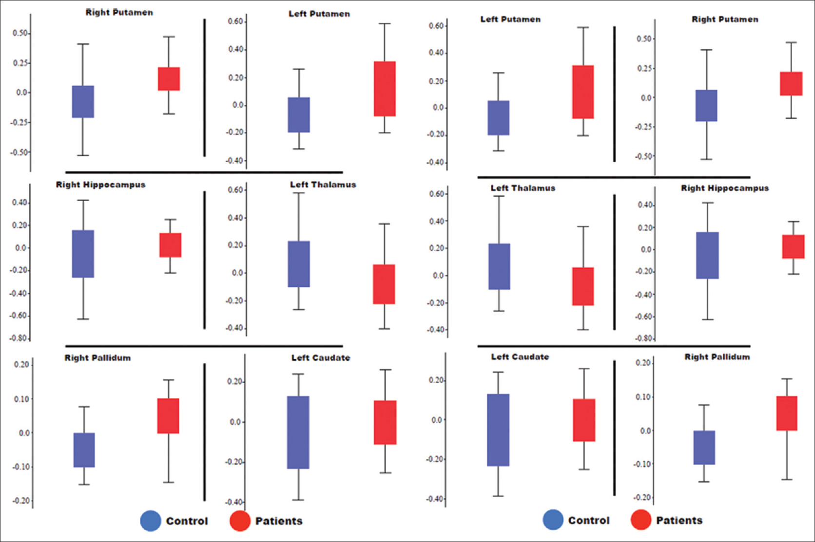 Box-and-whisker plots showing fractal dimensions of different subcortical regions (the right hippocampus, left and right putamen, left thalamus, left caudate, and right pallidum) for both groups. Red boxes, schizophrenia patients; blue boxes, controls. Boxes enclose 50% of the data and the whiskers show the range.