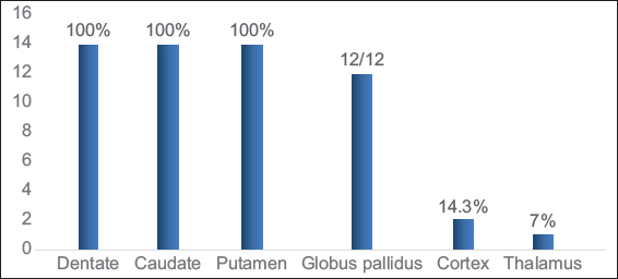 Gray matter involvement in L-2-hydroxy glutaric aciduria.