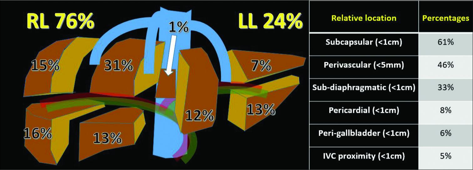 Distribution of lesion location within the liver and in relation to vessels and anatomic structures (n = 100).