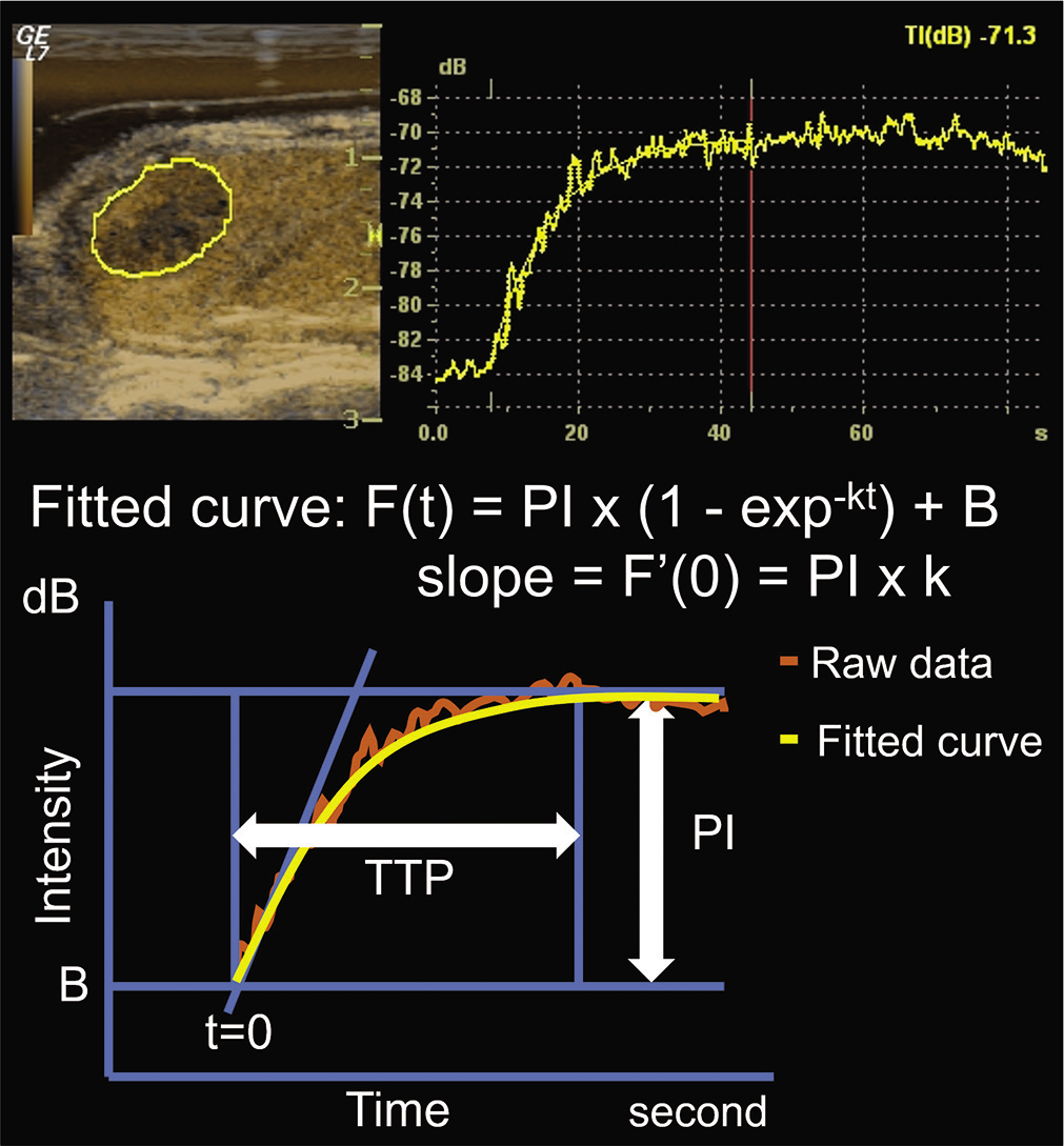 DCE-US and the fitted curve constructed from the raw data. DCE-US was conducted for 85 s and the following four parameters were extracted from the fitted curve: PI, k value, wash-in slope (PI × k), and TTP. DCE-U: Dynamic contrast-enhanced ultrasonography, PI: Peak intensity, TTP: Time to peak.