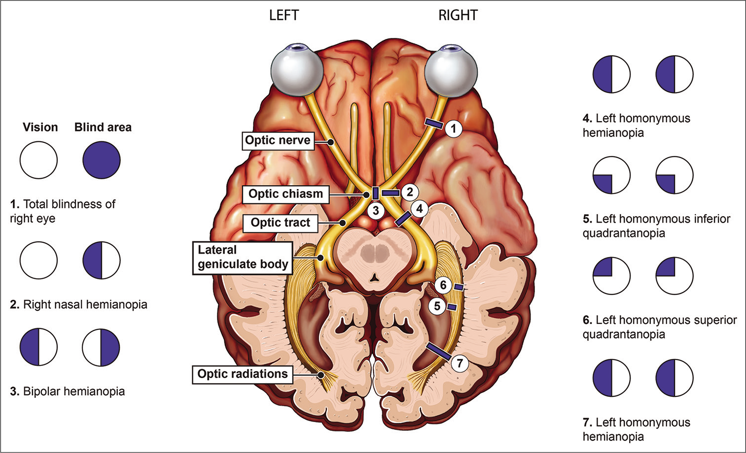 Visual Pathways In Parietal And Temporal Lobes Sexiz Pix