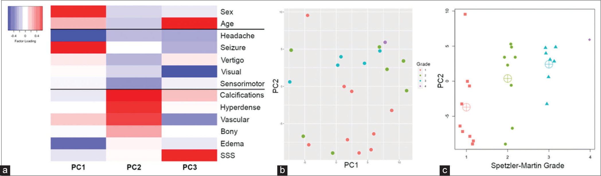 (a-c) Results from logistic PCA. Panel A provides factor loadings for the 3-component solution that included demographic, clinical, and imaging features; this analysis accounted for 71% of the deviance in 13 binary predictors. Panel B is a scatterplot between the two largest principal components, with subjects color coded by Spetzler-Martin grade. Panel C shows the relationships between the component dominated by imaging features (PC2) and Spetzler-Martin grade. Crosshairs represent group means.