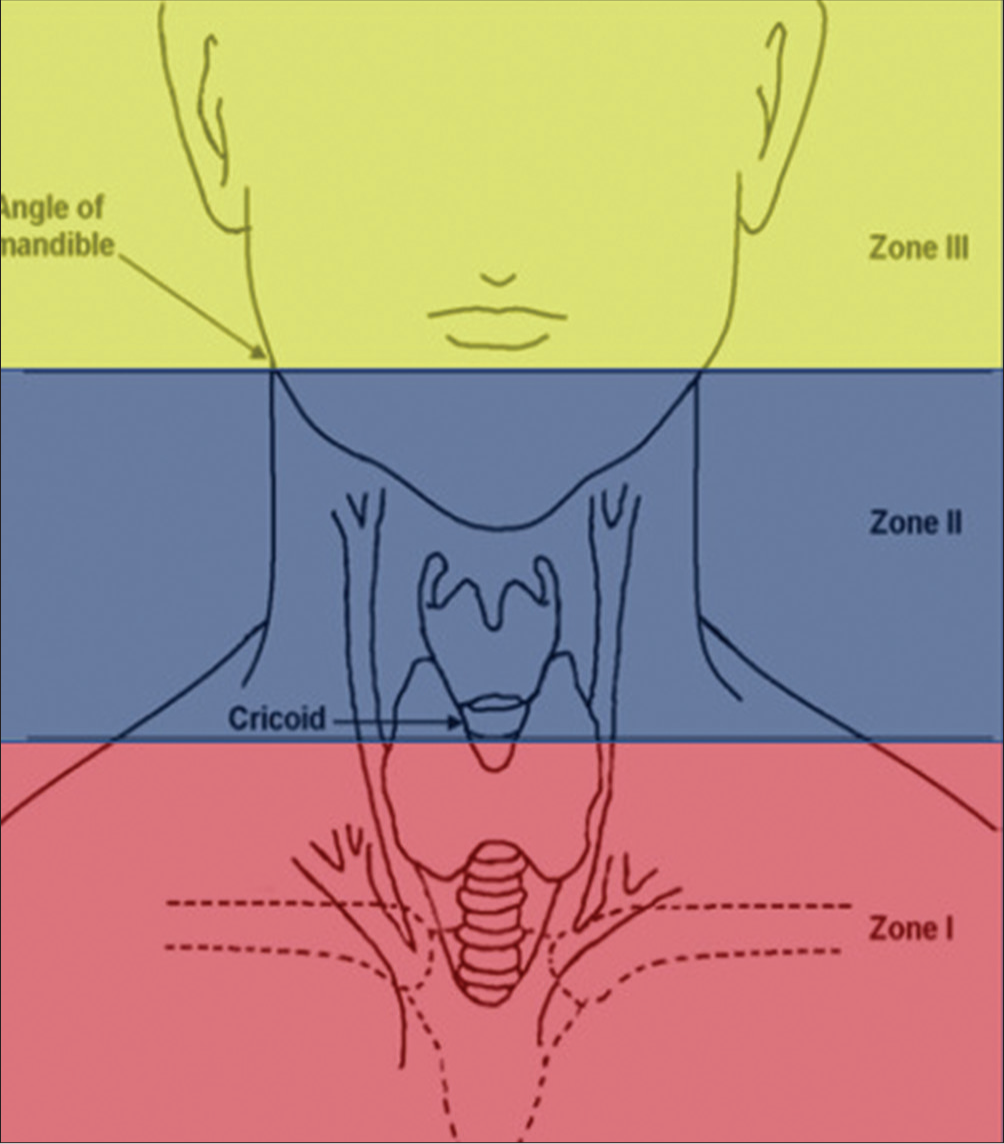 Zones of neck.