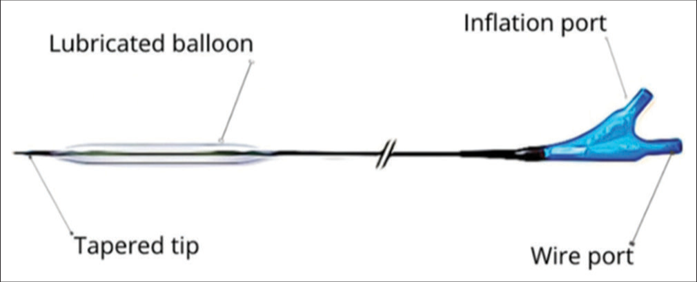 Balloon-assisted gastrostomy tube model.