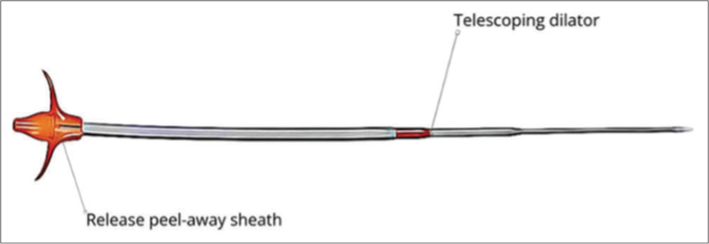 Serial dilator gastrostomy tube model.