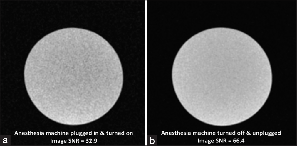 Phantom testing showed (a) image signal-to-noise ratio was lower when an anesthesia machine positioned near the magnet was plugged into a wall outlet inside the magnetic resonance scanner room and turned on compared to (b) image signal-to-noise ratio after the anesthesia machine was turned off and unplugged.