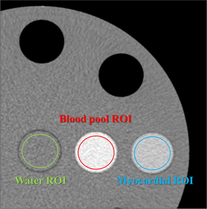 Measurement of computed tomography (CT) number. Region of interests (ROIs) were used to measure the CT numbers, and the mean value of 16 images/scan and 3 scans along the Z-axis was calculated for each keV image of virtual monoenergetic image. (The green circle represents the ROI for water, the red circle represents the ROI for the blood pool, and the blue circle represents the ROI for the myocardium).