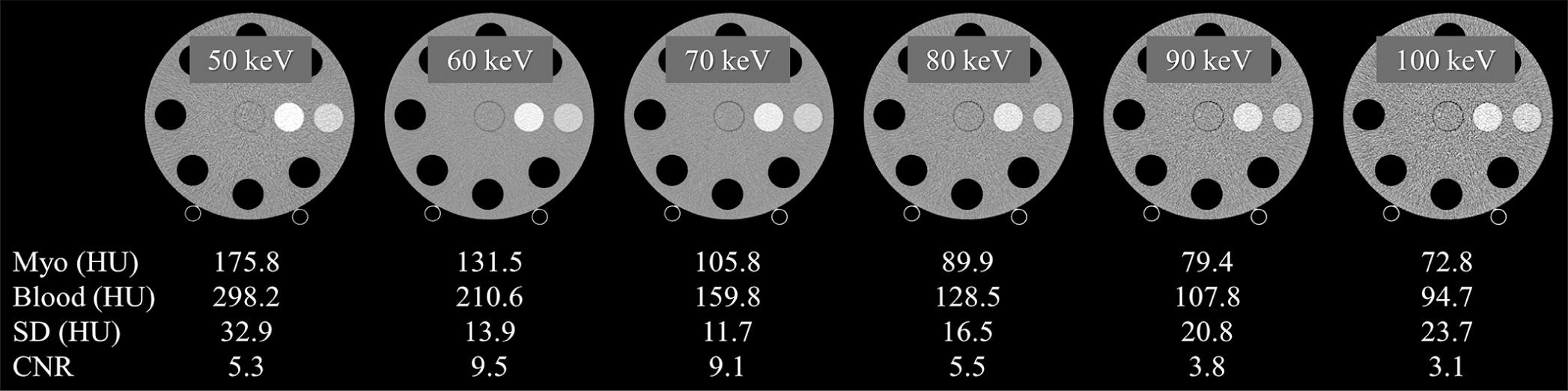 Computed tomography (CT) number, image noise (standard deviation), and contrast-to-noise ratio (CNR) for each keV image. CNRs were calculated based on the CT values of water and myocardium in the postcontrast images. The display window level/width is 0/600, 0/500, 0/400, 0/350, 0/300, and 0/250 for 50 keV, 60 keV, 70 keV, 80 keV, 90 keV, and 100 keV, respectively. (HU: Hounsfield unit).